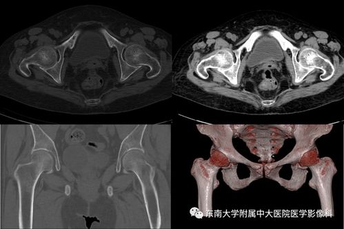 骨髋系统,人体运动系统的骨骼与关节结构解析