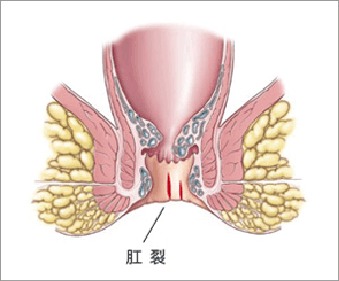 肛门系统,结构功能与常见疾病解析